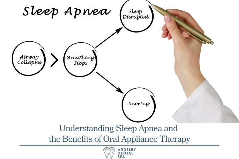 Understanding Sleep Apnea and the Benefits of Oral Appliance Therapy