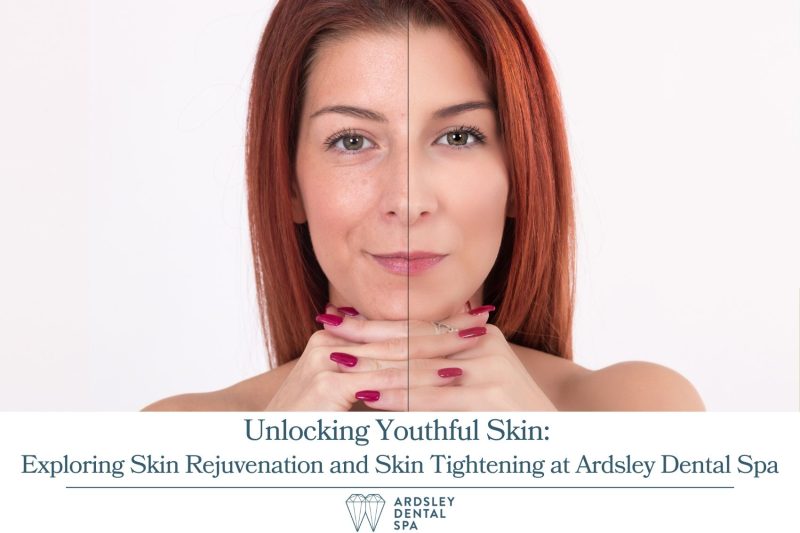 Unlocking Youthful Skin: Exploring Skin Rejuvenation and Skin Tightening at Ardsley Dental Spa